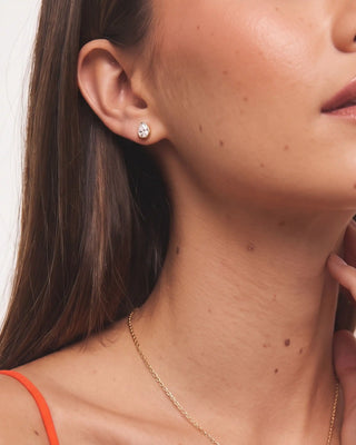 Aretes